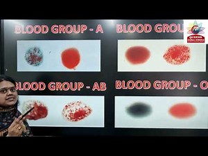 Blood Groups & Types Explained | Universal Donor, Recipient & Transfusion | Global Schools