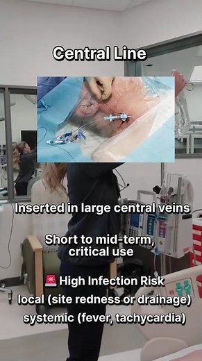 Central Line vs PICC Line | Know the Difference