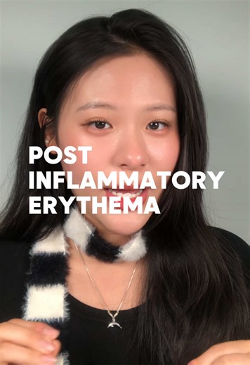 3 Ingredients to Fade Post-Inflammatory Erythema