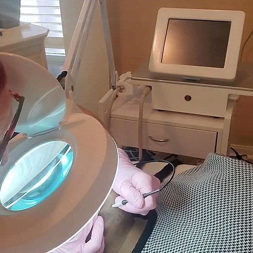 Understanding Electrolysis vs. Laser Hair Removal – The Truth About Permanent Hair Removal!