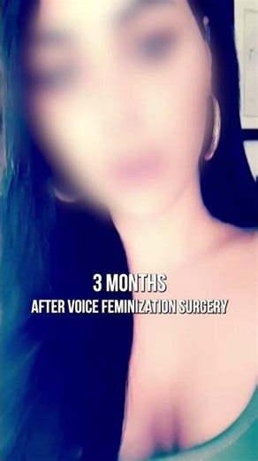 Voice Feminization: 6-Month Patient Process