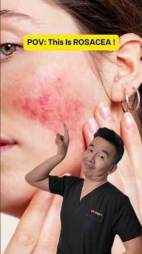 This is why your face gets red FAST.