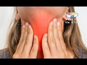 Los síntomas de la faringitis aguda