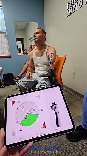 IBT Glide Pattern Recognition | Prosthetic Innovations