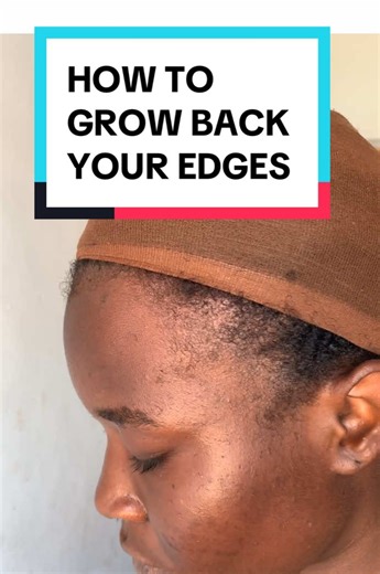 How to Grow Back Your Edges Fast and Effectively