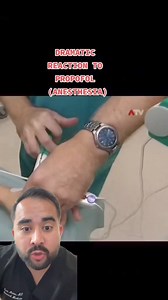 5.4K views · 64 reactions | Dramatic reaction to anesthesia propofol #anesthesia #surgery #doctorreacts #physician #medical #medicine #doctor | Inside Anesthesia | Facebook