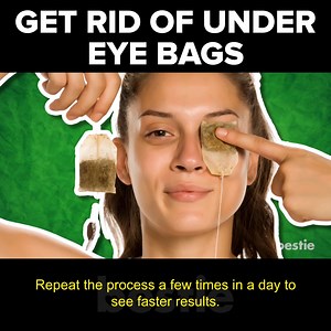3.2K views · 88 reactions | 10 Easy Home Remedies To Get Rid Of Under Eye Bags #BagsUnderEye #UnderEyeBags #Bestie Sources: https://pastebin.com/feEdQfXv | Bestie | Facebook