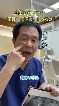 If tooth decay is left untreated, will it lead to "odontogenic maxillary sinusitis"?