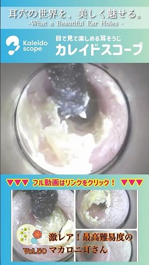 でるでる壁から耳垢 #耳掃除 #earcleaning