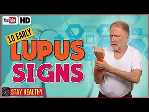 10 Lupus Disease Symptoms and Causes