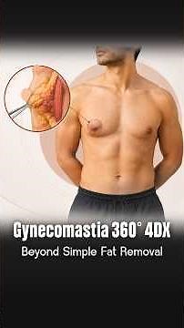 Why 360° 4DX for Gynecomastia? | Complete Chest Contouring | Dr Amit Gupta