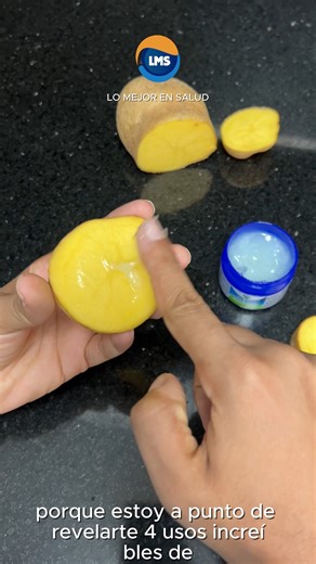 cinco usos increíbles del Vick Vaporub que te cambiarán la vida | Lo Mejor en Remedios Naturales