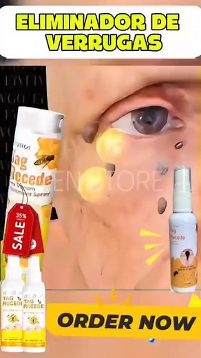 🚫 ¿Te molestan las verrugas o pequeñas imperfecciones en la piel? Descubrí XIMONTH™ Bee Venom Repair Spray, un tratamiento natural que combina ácido acético y veneno de abeja 🐝 para eliminar verrugas desde la raíz y regenerar tu piel de forma progresiva. ✨ Elimina verrugas pequeñas y superficiales 🌿 Calma la inflamación y repara la piel dañada 💧 Protege y humecta la zona tratada Usalo 2 veces al día y notá cómo tu piel recupera su apariencia limpia, lisa y saludable. 📦 Envío GRATIS a todo P