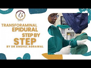 Transforaminal Epidural, How i do it ? Back & Neck Pain Treatment Experts | Dr. Anshul Agarwal