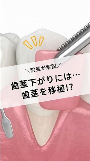 The clinic director explains! For receding gums... can we transplant gum tissue!? #NakanoDentalCl...