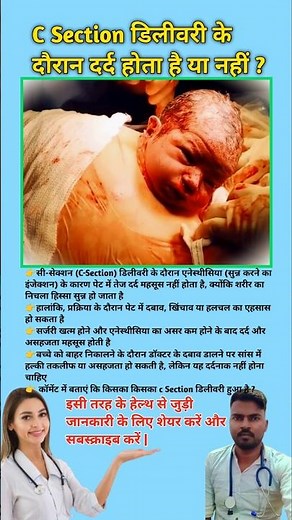 C Section डिलीवरी के दौरान दर्द होता है या नहीं ? C Section Delivery tips || #viral #csection