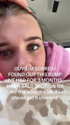 Understanding Hair Bumps and Bald Spots: Expert Insights