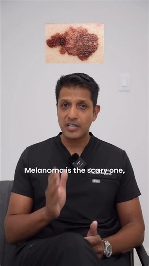 3 Most Common Types Of Skin Cancer