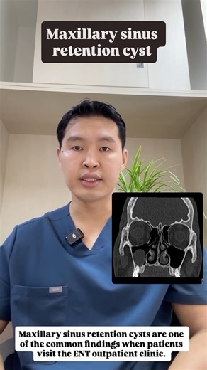 Purevdorj Sukhbaatar on Instagram: "Maxillary sinus retention cysts are one of the common findings when patients visit the ENT outpatient clinic. These cysts are benign, fluid-filled sacs that usually form along the floor of the maxillary sinus. Most of the time, they are discovered incidentally, are asymptomatic, and don’t require treatment. They form when the small mucous gland ducts become obstructed, causing mucus to accumulate under the lining of the sinus. Because they are often found inci
