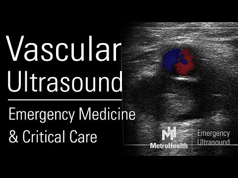 Vascular Ultrasound in Emergency Medicine & Critical Care