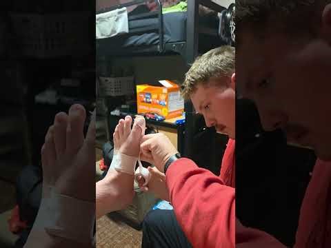 Turf Toe Taping