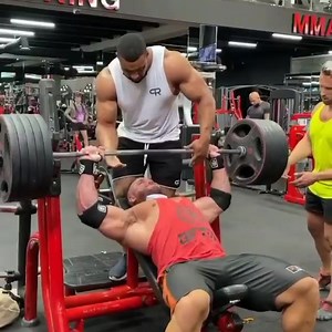 By @the_resuscitationist SPORTS MEDICINE: SOFT TISSUE INJURIES PECTORALIS MAJOR RUPTURE: CLINICAL: a rare injury patterns with typical sudden "tear/pop" sensation as the pectoralis major ruptures. Primarily men: 20-40yo (weightlifting) HOW? excessive tension on a maximally eccentrically contracted muscle -> tendon fails in a predictable sequence--> inferior fibers of sternocostal head fail first, then superior fibers of the sternocostal head, and finally the clavicular head. EXAM: severe ecchymo