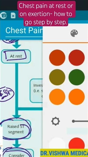 Chest pain at rest or on exertion- how to go step by step. ALGORITHMIC APPROACH. .