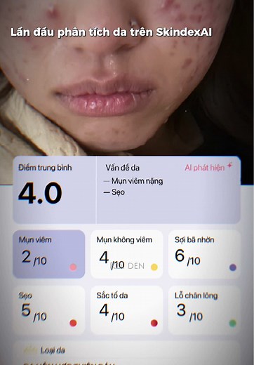 Tải SkindexAI: Phân Tích Da và Routine Cá Nhân Hóa