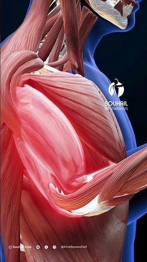 Lateral epicondylitis explained in 30 seconds