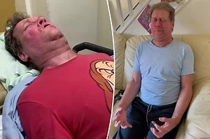 What it’s really like to have stiff person syndrome and ‘freeze like a statue’