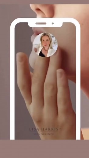 LISA HARRIS SKIN SCIENCE on Instagram: "Link in bio to find out more and to book with Lisa. We look forward to seeing you soon. www.lisaharrisskinscience.co.uk Follow us on Instagram @lisaharris_skinscience Call us on 01932 841717 🔘Link in bio for more about Lisa Harris 🔘 #lisaharris #love #doctors #facelift #naturallips #lips #NonSurgicalFacelift #beauty #beautiful #transformation #makeover #celebritymakeover #weybridge #safefacials #epione #skin #beauty #jawline #facelift #reelinstagram #Fiv