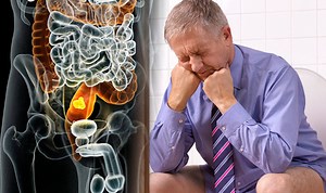 Bowel cancer symptoms: Four signs to check when you go to the toilet