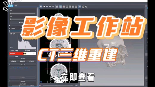#影像工作站 #CT三维重建 #3D #三维可视化 #后处理系统 #GPU