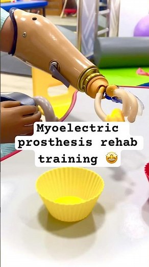 How to train ADLs with myoelectric prosthesis 🔥| Bilateral upper limb amputee warrior 💪|