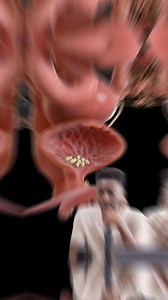 5.3K views · 147 reactions | What are bladder stones? 流﫧When minerals...