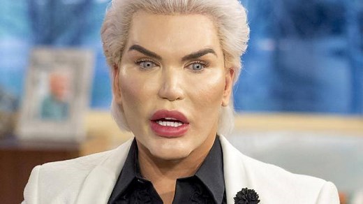 The Human Ken Doll, Rodrigo Alves has had 60 surgeries. Our experts discuss extreme plastic surgery. | The Plastic Surgery Channel