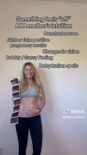 Understanding Cryptic Pregnancy: Signs, Symptoms, and Realities