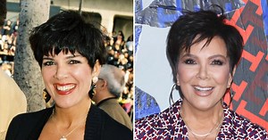 Kris Jenner Plastic Surgery: Transformation Photos Then and Now