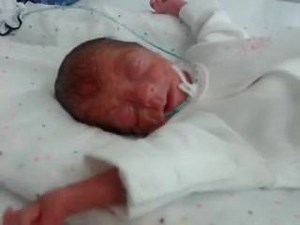 6.3K views · 440 reactions | I found this footage of my daughter. The first time I saw her face clearly which was just for a brief 90 seconds whilst they changed her CPAP. she weighed 1lb 12oz in this footage. Feel free to share any special videos you have. Eleanor is now two and a half and doing great :) | Little Miracles UK | Facebook