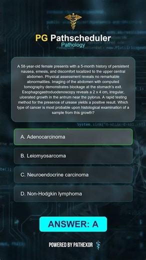 Gastric Cancer: Pyloric Ulcer #Shorts