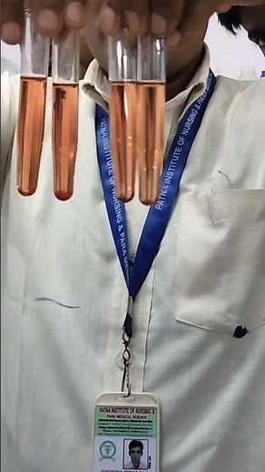 osmotic Fragility test