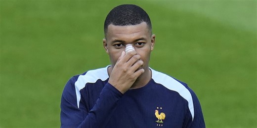 Kylian Mbappe's mask revealed after breaking nose at Euro 2024
