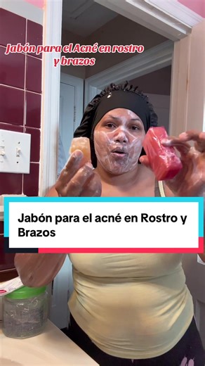 Lávense de día y noche con el jabón y después se ponen crema hidratante por que reseca la piel porque seca los granos lo recomiendo mucho porque a mi niña le ayudado mucho 10/10🥰#JavondeVivoraparaelAcne#AcneJavon#RostroBrazos#creenscreenvideo #acneBarSoapbofyWash