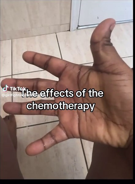 Understanding Chemotherapy Symptoms and Side Effects