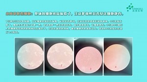 HepG2(人肝癌细胞)详细介绍