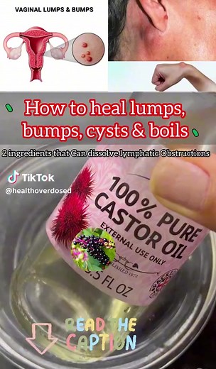 478K views · 2.6K reactions | Great Uses of Castor Oil You Didn’t Know Before! #castoroil #castoroilbenefits #CastorOilChallenge | Natural Love Page | Facebook