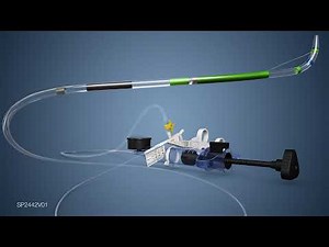 StoneMasterV Sphincterotome and Dilation Balloon