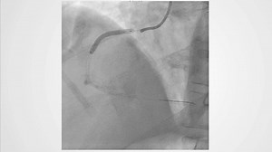 Today’s video is an impressive case-demonstration of the acute...