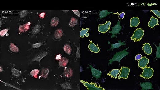 Nanolive's Cytotoxicity Assay for Co-cultures: A New Approach | Ceri Wilson posted on the topic | LinkedIn