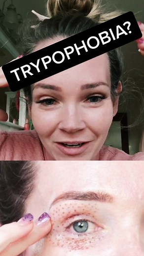 Understanding Trypophobia: Causes, Symptoms, and Treatment